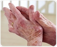 EULAR 2026 highlights rising comorbidity risks in rheumatic disease