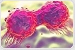 Machine learning helps predict risks during stem cell therapy for myeloma