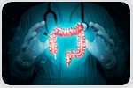 Chronic colitis reshapes colon stem cells in ways that can accelerate tumour growth