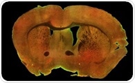 Two-Photon Imaging Reveals Brain Mitophagy Decline