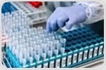 Revolutionizing calibration: How Lumo uses machine learning to streamline E&L screening and toxicological risk assessment