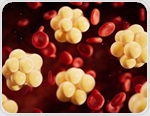 Elite athletes with higher vitamin D show healthier lipid profiles