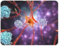 Alzheimer’s monoclonal antibodies fail to deliver meaningful results