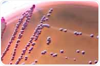 Gut bacteria may help explain why fatigue appears before illness