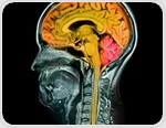 Drug Boosts Axon Regrowth In Human Brain-Spinal Cord Model
