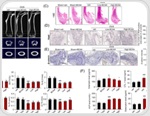 Exploring BCAA supplementation in osteosarcopenia research
