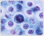 Skin barrier monitoring predicts necrosis after skin flap surgery