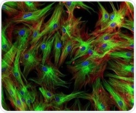 Researchers uncover key mechanism driving chronic Sjögren disease