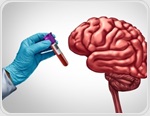 Blood metabolites reveal lifestyle links to brain health before dementia
