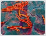 Scientists find a universal gut microbiome pattern linked to colorectal cancer