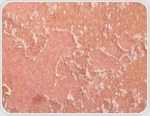 New Study Reveals How Skin Immune Cells Shape Long-Term Health