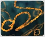 How clinicians can identify and manage Ebola, hantavirus