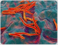 Scientists find a universal gut microbiome pattern linked to colorectal cancer