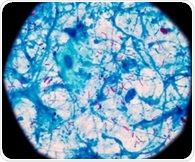 Researchers identify control switch protein that starves tuberculosis bacteria