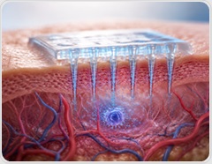 Cosmetic microneedles deliver actives where creams struggle