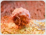 Allergies show a small but significant link to later cancer risk