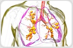 Southern Medical University Uncovers Crucial Protein Linked to Lung Fibrosis