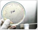 Why Rare E. coli Genes Rarely Create New Metabolic Functions