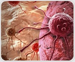 Study highlights breast screening barriers facing Black women in Britain