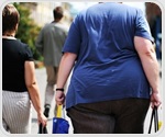 Study: Bariatric surgery is safe, effective for obese adolescents and young adults