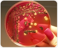 Gut immune cells help prevent severe salmonella infections