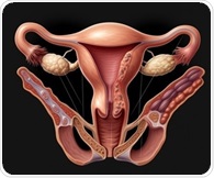 Endometriosis affects multiple body systems beyond pelvic pain