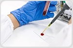 Antibody Drug Conjugate Treatment Destroys Hidden B Cell Leukemia