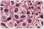 Antibody-Based Strategy Makes Stem Cell Transplants Safer
