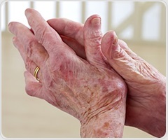 Exercise may provide limited relief for hip osteoarthritis symptoms