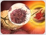 Red meat intake emerges as a potential pancreatic cancer risk factor
