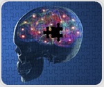 Clinical trial finds stem cell brain transplants feasible for Parkinson's disease