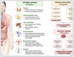 Too little or too much iodine may push immunity off balance