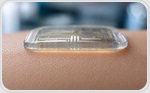 Wearable microneedle sensor enables in vivo bioanalysis of cardiac biomarkers