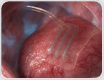 Bioresorbable sensor tracks deep-tissue lactate for over 10 days in animals