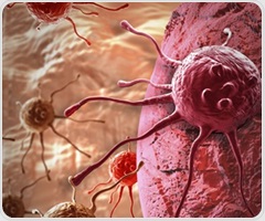 Study of lung immune cells uncovers roots of autoimmune disease