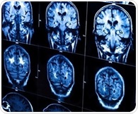 Discovery of calcium channel mechanism offers clues for brain disorder treatments