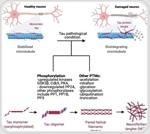 How Tau is transforming the future of Alzheimer’s diagnosis and treatment