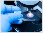 How AI predicts molecular biomarkers from H&E slides