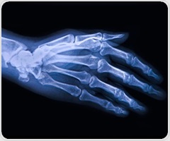 Scientists map key differences in stem cell potency for treating knee osteoarthritis