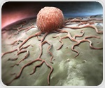 Study identifies a novel direct drug target for head and neck squamous cell carcinoma