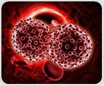 New study uncovers metabolic vulnerability in high-risk myelodysplastic syndromes