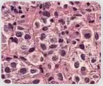 Research Maps Structural Mechanism Linking Amino Acid Availability to Cancer Growth