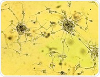 Cannabis compounds may weaken glioblastoma response to chemotherapy and radiation