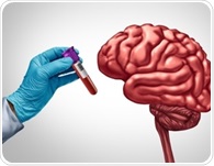 Semaglutide slows blood protein signature linked to future dementia risk