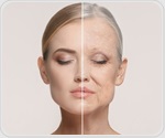 New USC center seeks answers to sex differences in aging