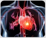 Dysregulated immune cells drive hidden inflammation after heart attacks