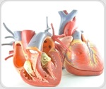 Huge philanthropic grant funds pioneering stem cell-based heart attack therapy