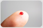 New portable blood testing device allows remote health monitoring