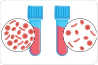 Ion channel TPC1 identified as key regulator of iron homeostasis