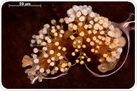 Study reveals hidden myxobacteria diversity for future drug discovery
